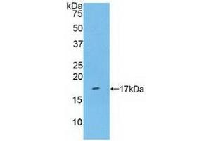Detection of Recombinant KLRB1, Human using Polyclonal Antibody to Cluster Of Differentiation 161 (CD161) (CD161 anticorps  (AA 73-188))