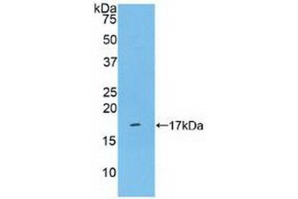 CD161 anticorps  (AA 73-188)