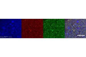 Immunohistochemistry (IHC) image for anti-Dopa Decarboxylase (Aromatic L-Amino Acid Decarboxylase) (DDC) antibody (ABIN7456246)