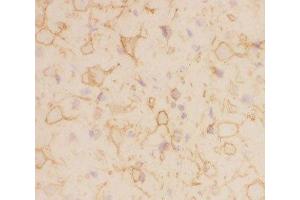 IHC-F staining of rat brain tissue (Kv2.1/KCNB1 anticorps  (AA 687-858))