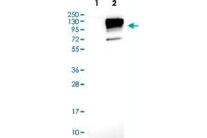 Western blot analysis of Lane 1: Negative control (vector only transfected HEK293T lysate) Lane 2: Over-expression lysate (Co-expressed with a C-terminal myc-DDK tag (~3. (Neuroligin 3 anticorps)
