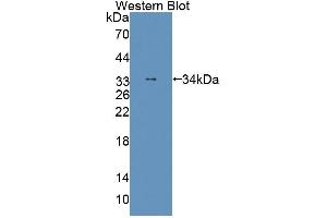 Western blot analysis of the recombinant protein. (THYN1 anticorps  (AA 1-225))