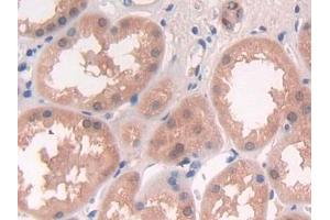 DAB staining on IHC-P; Samples: Human Kidney Tissue (DGKE anticorps  (AA 243-502))