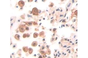 IHC-P analysis of Human Tissue, with DAB staining. (CDC42 anticorps  (AA 1-188))