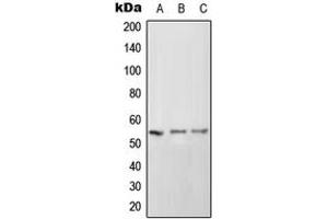 Western blot analysis of CD102 expression in HeLa (A), SP2/0 (B), PC12 (C) whole cell lysates. (ICAM2 anticorps  (Center))