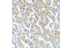 Immunohistochemistry of paraffin-embedded human liver injury using INADL antibody at dilution of 1:100 (x40 lens). (PATJ anticorps)