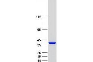 Validation with Western Blot