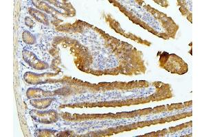 IHC analysis of EIF4G1 using anti-EIF4G1 antibody (ABIN7601860).
