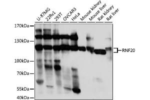 Western blot analysis of extracts of various cell lines, using RNF20 antibody (ABIN7270072) at 1:1000 dilution. (RNF20 anticorps  (AA 1-260))