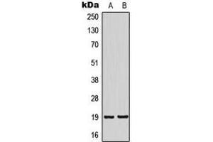 Western blot analysis of NSG2 expression in SHSY5Y (A), HeLa (B) whole cell lysates. (NSG2 anticorps  (Center))