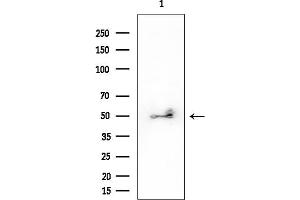 Western blot analysis of lysates from EC304 cells, using AQP1 Mouse Monoclonal Antibody at 1/1000 dilution.