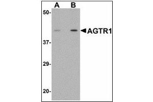 Western blot analysis of AGTR1 in mouse kidney tissue lysate with AGTR1 antibody at (A) 1 and (B) 2 µg/ml.