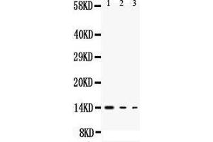 Anti-IL3 antibody, Western blotting All lanes: Anti IL3  at 0. (IL-3 anticorps  (Middle Region))