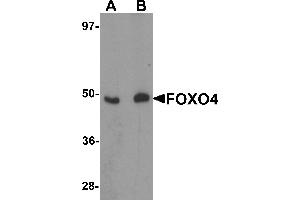 Western Blotting (WB) image for anti-Forkhead Box O4 (FOXO4) (N-Term) antibody (ABIN1031385) (FOXO4 anticorps  (N-Term))
