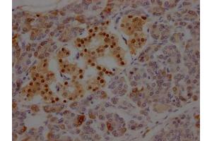 IHC image of ABIN7127582 diluted at 1:100 and staining in paraffin-embedded human pancreatic tissue performed on a Leica BondTM system.