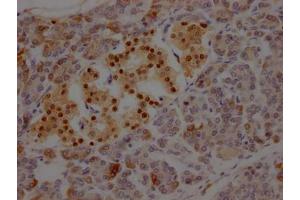 IHC image of ABIN7127582 diluted at 1:100 and staining in paraffin-embedded human pancreatic tissue performed on a Leica BondTM system. (Recombinant ISL1 anticorps)