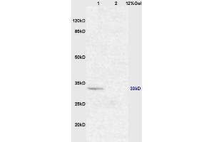 Lane 1: mouse brain lysates Lane 2: mouse intestine lysates probed with Anti XAF1/FBXO39 Polyclonal Antibody, Unconjugated (ABIN674754) at 1:200 in 4 °C. (XAF1 anticorps  (AA 151-250))