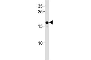 HMGA2 antibody western blot analysis in HepG2 lysate.