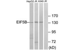 Western blot analysis of extracts from Jurkat/HepG2/A549 cells, using EIF5B Antibody. (EIF5B anticorps  (AA 1051-1100))