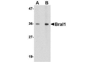 Western blot analysis of BRAL1 in human brain tissue lysate with BRAL1 antibody at (A) 1 and (B) 2 μg/ml. (HAPLN2 anticorps  (Center))