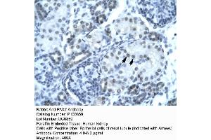 Rabbit Anti-PAX2 Antibody  p100859 Paraffin Embedded Tissue: Human Kidney Cellular Data: Epithelial cells of renal tubule Antibody Concentration: 4. (PAX2A anticorps  (Middle Region))