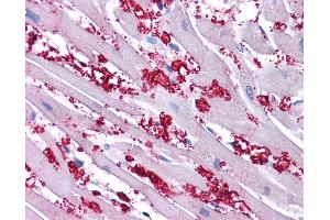 KCNA10 antibody was used for immunohistochemistry at a concentration of 4-8 ug/ml. (KCNA10 anticorps  (N-Term))