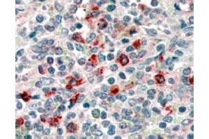 Image no. 1 for anti-CD14 (CD14) (Internal Region) antibody (ABIN374645) (CD14 anticorps  (Internal Region))