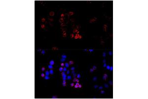 Immunofluorescence (IF) image for anti-ATP-Binding Cassette, Sub-Family G (WHITE), Member 8 (ABCG8) (AA 1-320) antibody (ABIN3022643)