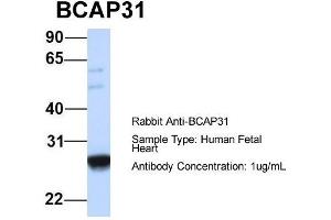 Host:  Rabbit  Target Name:  BCAP31  Sample Type:  Human Fetal Heart  Antibody Dilution:  1. (BCAP31 anticorps  (Middle Region))