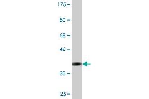Western Blot detection against Immunogen (37. (Syndetin/VPS50 anticorps  (AA 862-964))