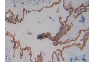 Detection of PZP in Mouse Esophagus Tissue using Polyclonal Antibody to Pregnancy Zone Protein (PZP)