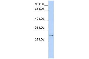 WB Suggested Anti-RCAN3 Antibody Titration:  0.