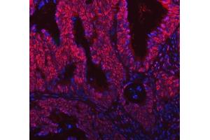 IF analysis of SNRNP200 using anti-SNRNP200 antibody (ABIN7602032).