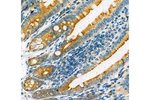Immunohistochemistry of paraffin embedded mouse duodenum using MAP7 (ABIN7074621) at dilution of 1:400 (400x lens)