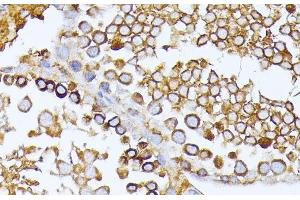 Immunohistochemistry of paraffin-embedded Rat testis using CAD Polyclonal Antibody at dilution of 1:100 (40x lens).
