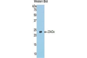 Detection of Recombinant CDHE, Mouse using Polyclonal Antibody to E-cadherin