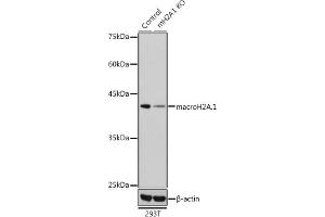 Western blot analysis of extracts from normal (control) and macroH2A. (H2AFY anticorps  (AA 123-372))