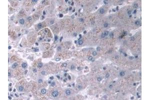 Detection of IFI35 in Human Liver Tissue using Polyclonal Antibody to Interferon Inducible Protein 35 (IFI35)