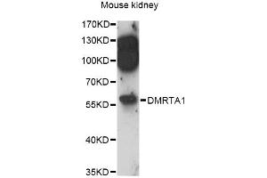 Western blot analysis of extracts of mouse kidney, using DMRTA1 antibody (ABIN6292013) at 1:3000 dilution. (DMRTA1 anticorps)