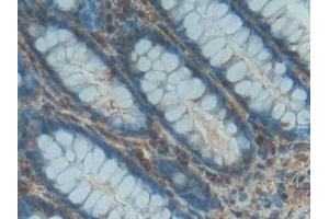 Detection of PDGF BB in Human Rectum Tissue using Polyclonal Antibody to Platelet Derived Growth Factor BB (PDGF BB) (PDGF-BB Homodimer (AA 82-190) anticorps)