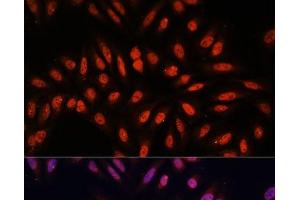 Immunofluorescence analysis of U-2 OS cells using KLHL8 Polyclonal Antibody at dilution of 1:100. (KLHL8 anticorps)
