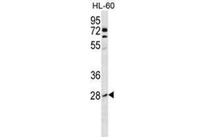 ARHB Antibody (Center) western blot analysis in HL-60 cell line lysates (35µg/lane).