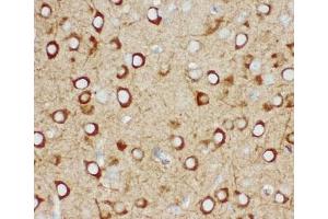 IHC-P: IP3R antibody testing of mouse brain tissue