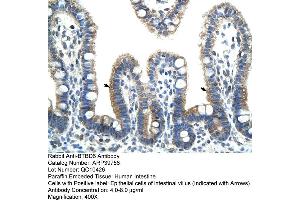 Human Intestine (BTBD6 anticorps  (N-Term))