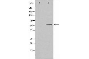 Western blot analysis of extracts from CoLo cells, using RBBP5 antibody. (RBBP5 anticorps  (Internal Region))