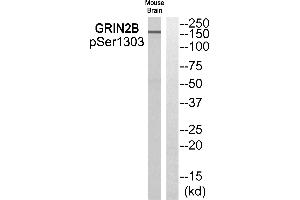 Western blot analysis of extracts from Mouse brain cells, using GRIN2B (Phospho-Ser1303) antibody. (GRIN2B anticorps  (pSer1303))