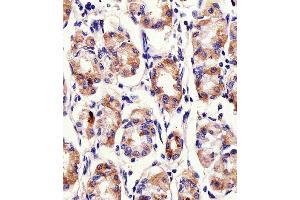 Immunohistochemical analysis of paraffin-embedded H. (PACSIN2 anticorps  (C-Term))