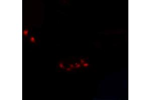 ABIN6266978 staining A-431 cells by IF/ICC. (SIX Homeobox 6 anticorps  (Internal Region))