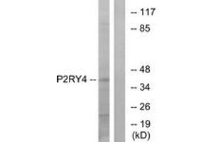 Western blot analysis of extracts from HeLa cells, using P2RY4 Antibody. (P2RY4 anticorps  (AA 159-208))