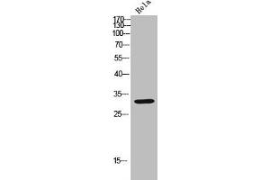 Western blot analysis of Hela lysate, antibody was diluted at 2000. (CDK6 anticorps  (AA 280-325))